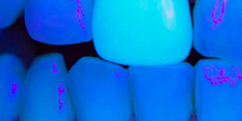 Color dientes