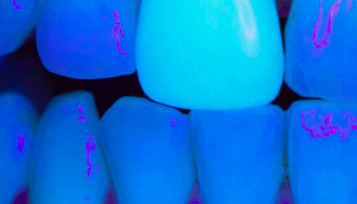 Color dientes